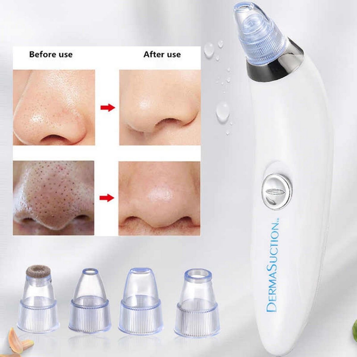 Derma Suction Facial Pore Cleanser