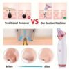 Derma Suction Facial Pore Cleanser