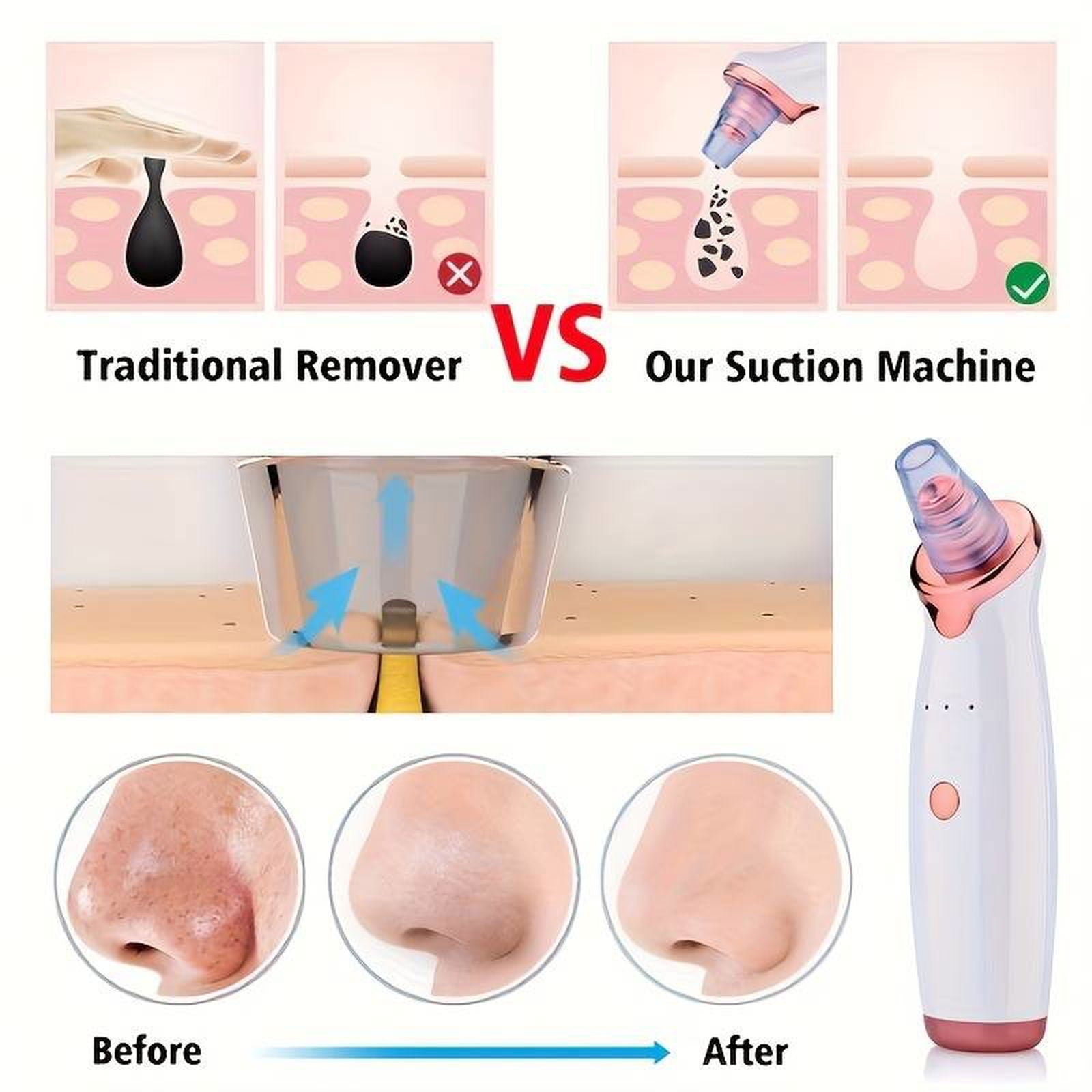 Derma Suction Facial Pore Cleanser